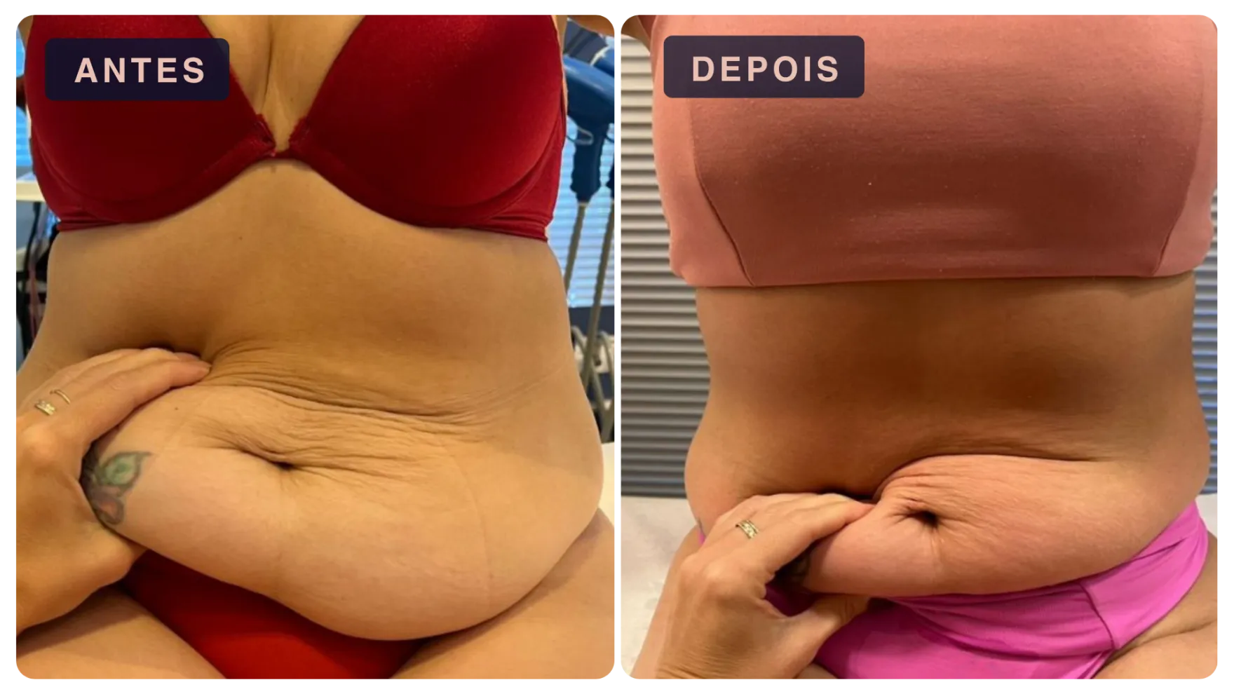 Paciente antes e depois do tratamento