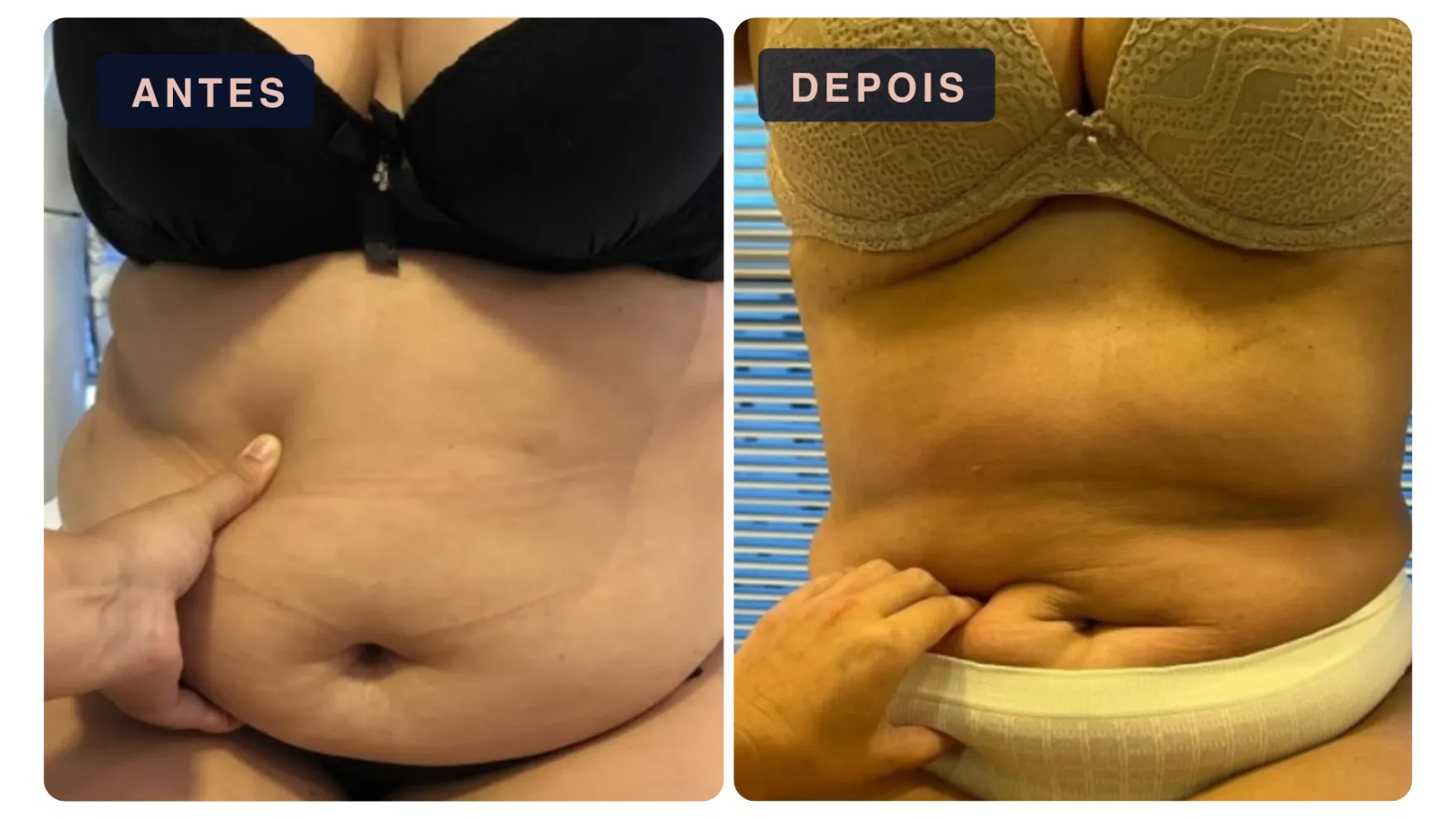 Paciente antes e depois do tratamento